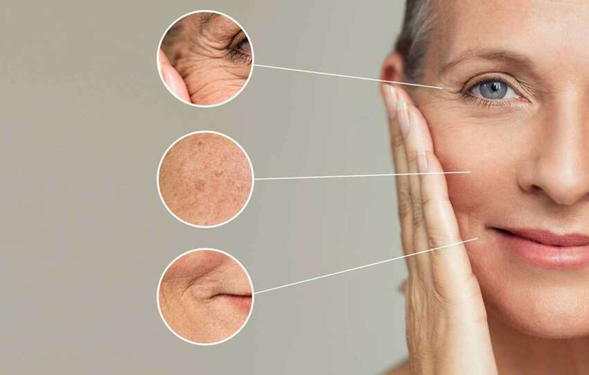 Five Anti-Aging Facial Yoga Exercises