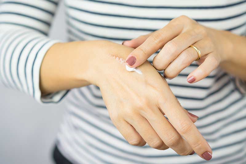 slow-healing-of-wounds