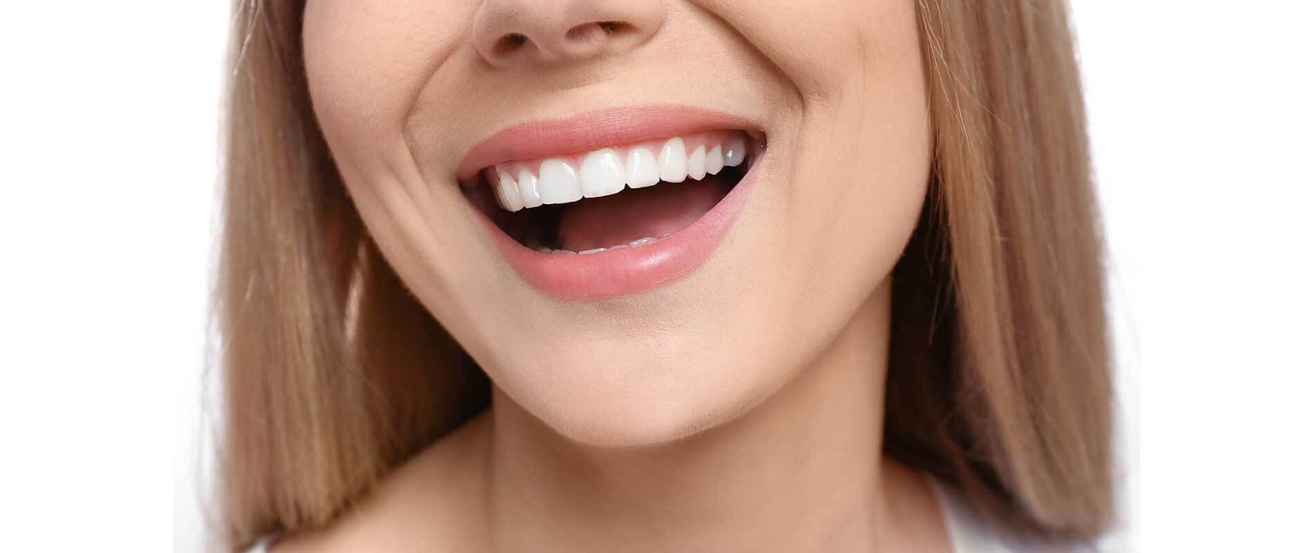 Teeth Whitening Naturally At Home