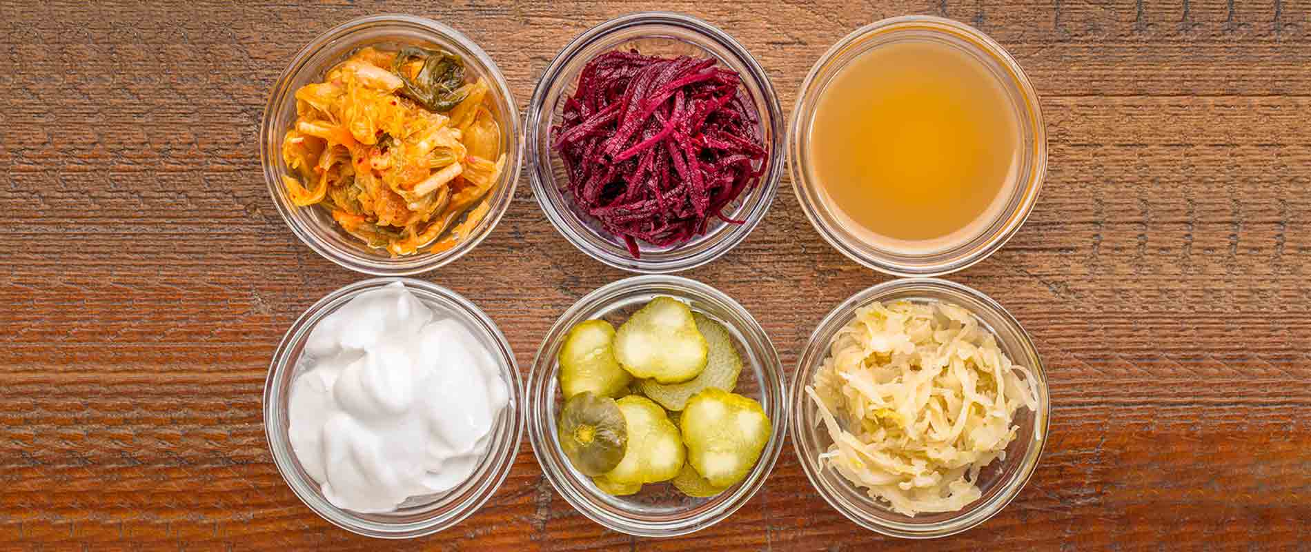 Fermented-Foods-Recipe-For-Gut-Health