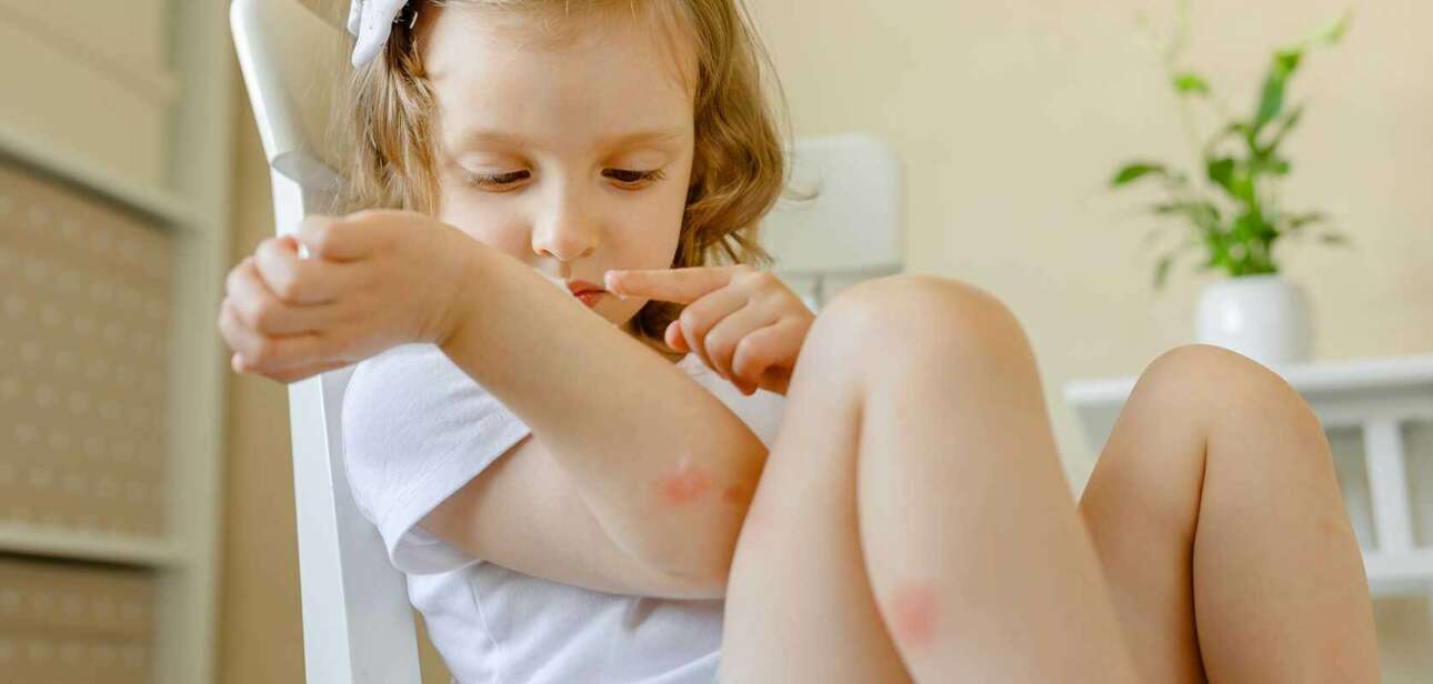 Allergies In Children