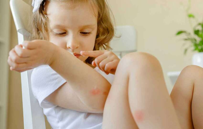 Allergies In Children