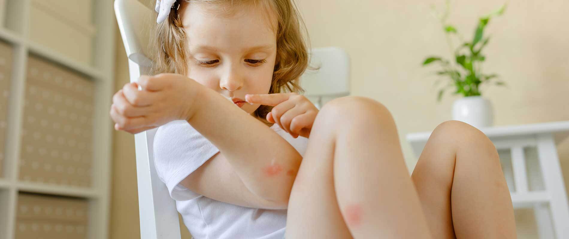 Allergies In Children