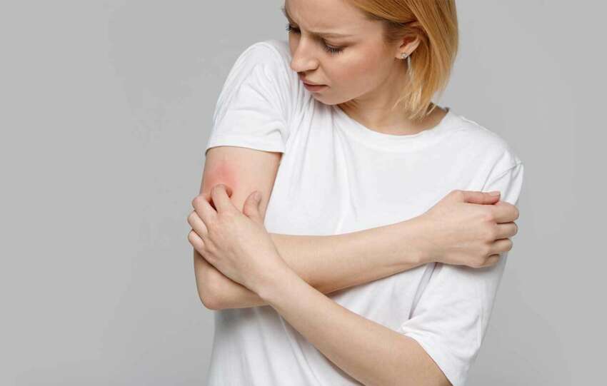 Stress and Allergies