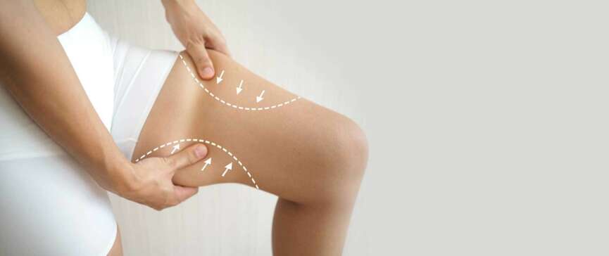 Reduce Thigh Fat