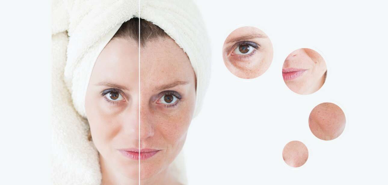 Yoga Poses for Anti-Aging