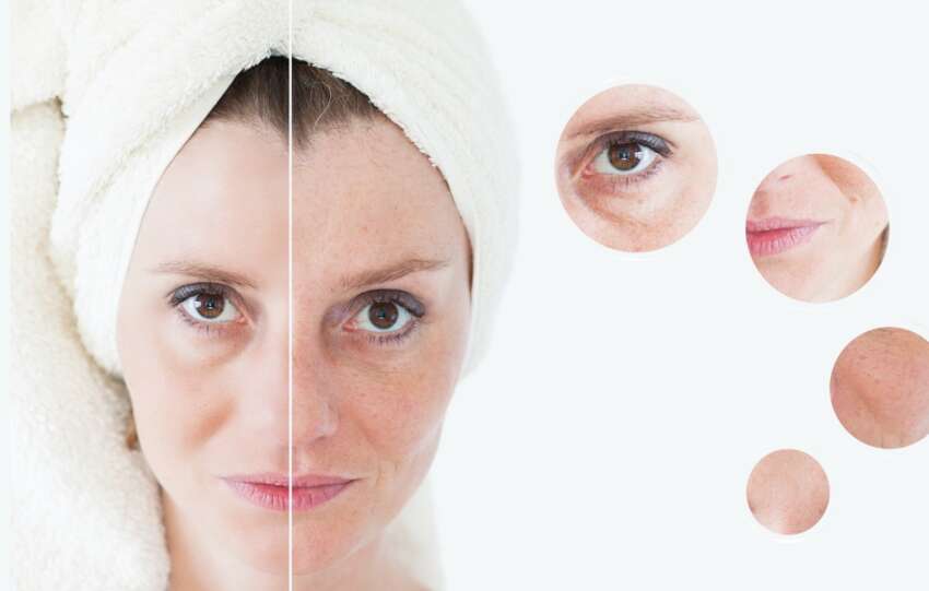 Yoga Poses for Anti-Aging